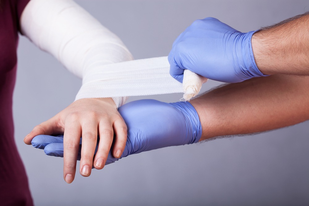 First Aid for Dislocations: How to Handle an Emergency Situation